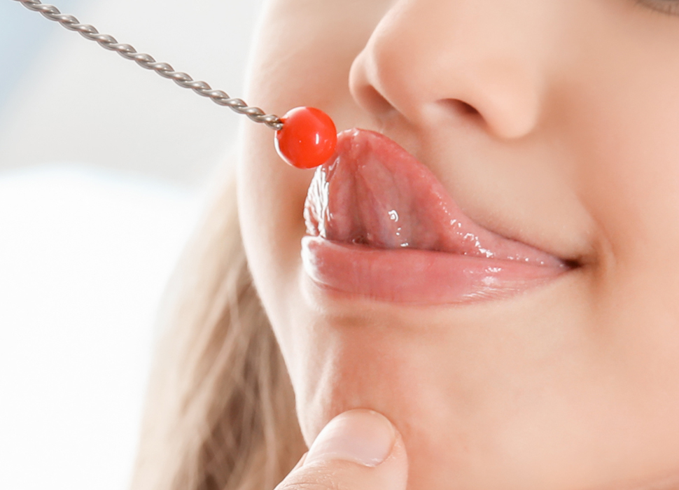 口腔筋機能療法（MFT）とは？