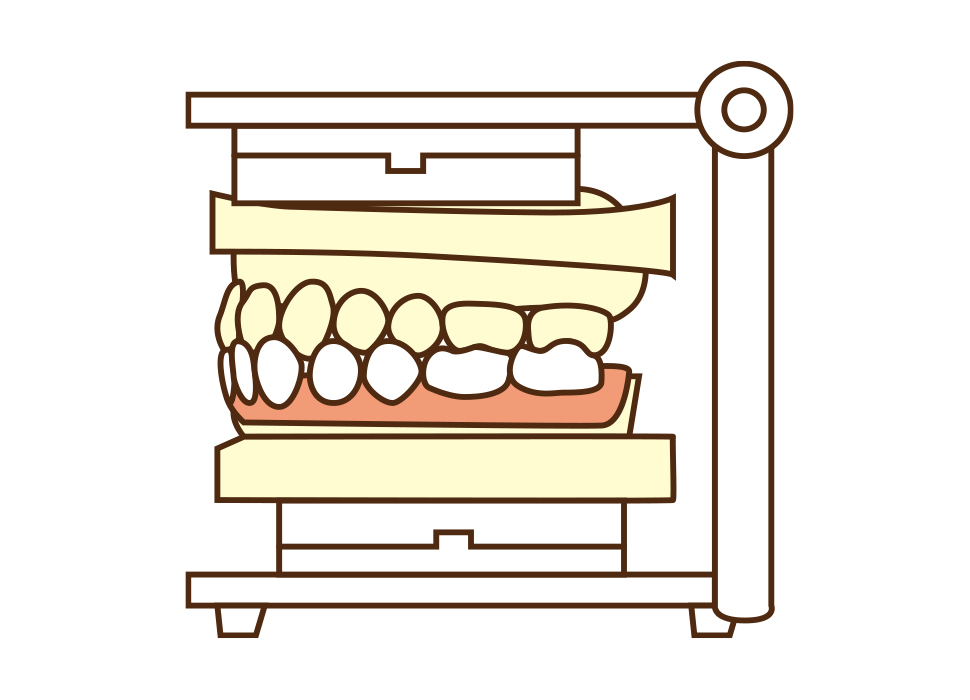 ④入れ歯の設計